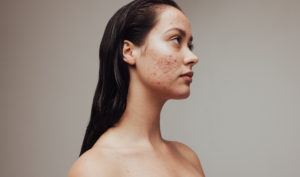 Allantoin skincare ingredient numelab switzerland woman
