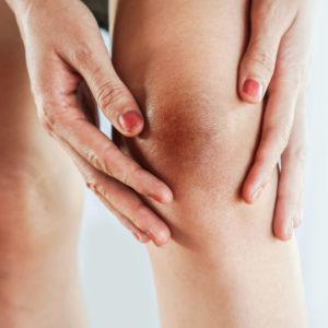 dry skin lower leg lower leg