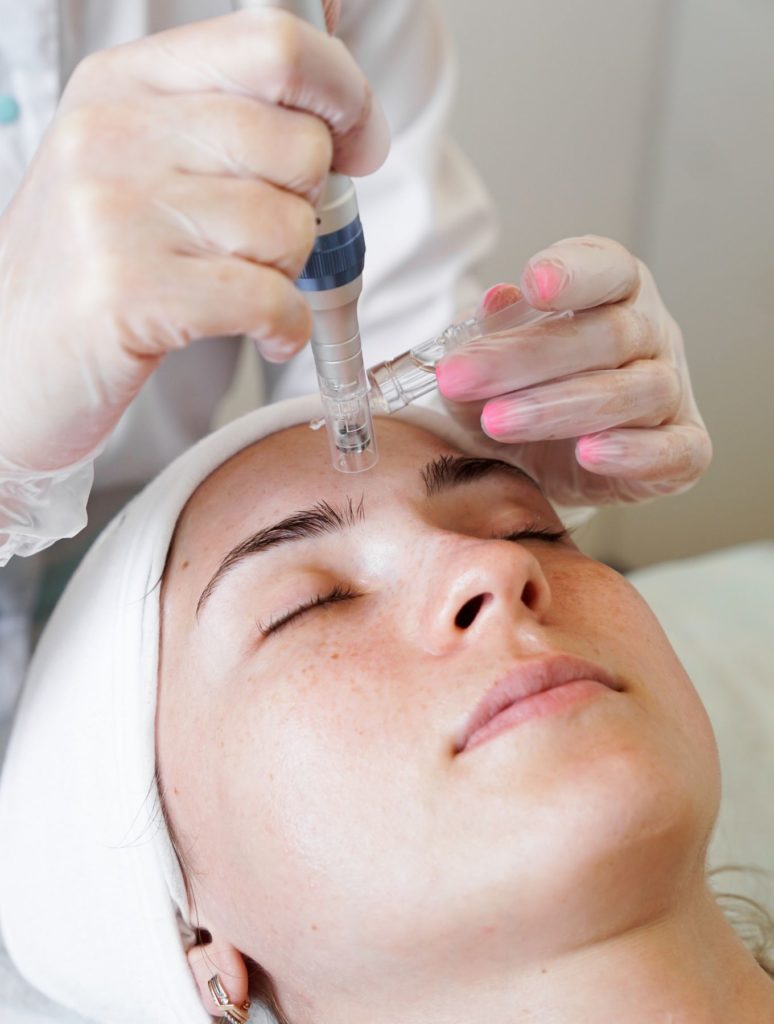 microneedling numelab skincare