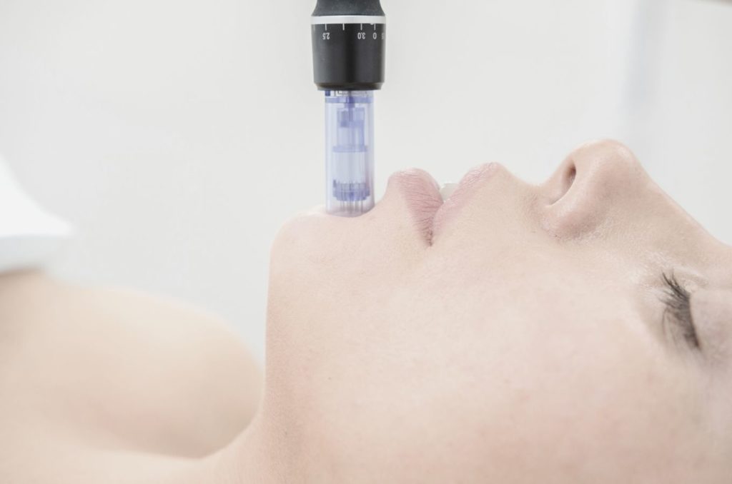 microneedling numelab skincare snail mucin