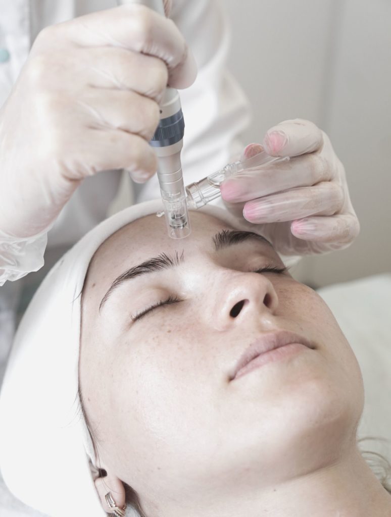 microneedling skincare numelab